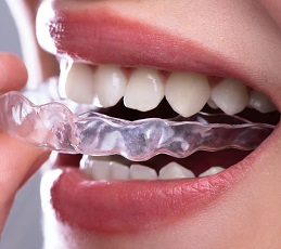 procedimiento_re_dental_clinica_dental_implantesdentales_valencia_espana